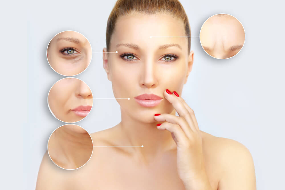 Kada je vreme za BOTOX?
