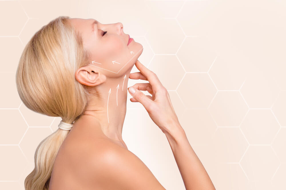 Face lifting