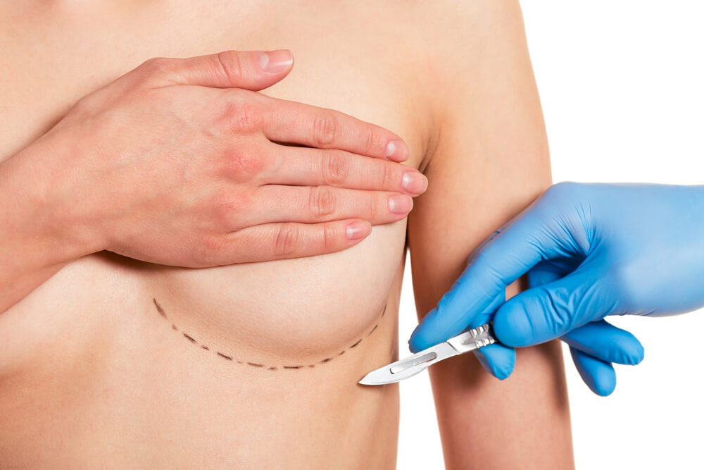 Ugradnja silikonskih implantata