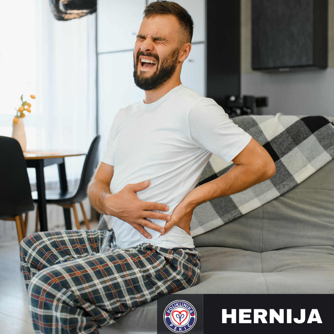 Šta je hernija? Poliklinika Pekić Novi Sad