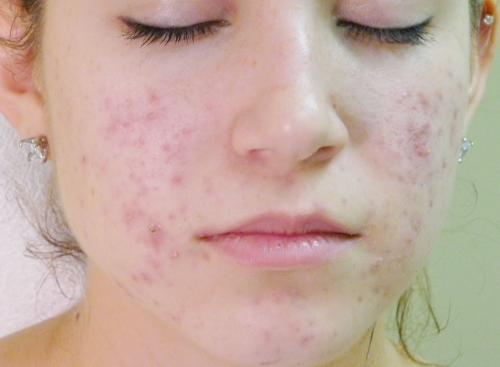 dermatolog novi sad
