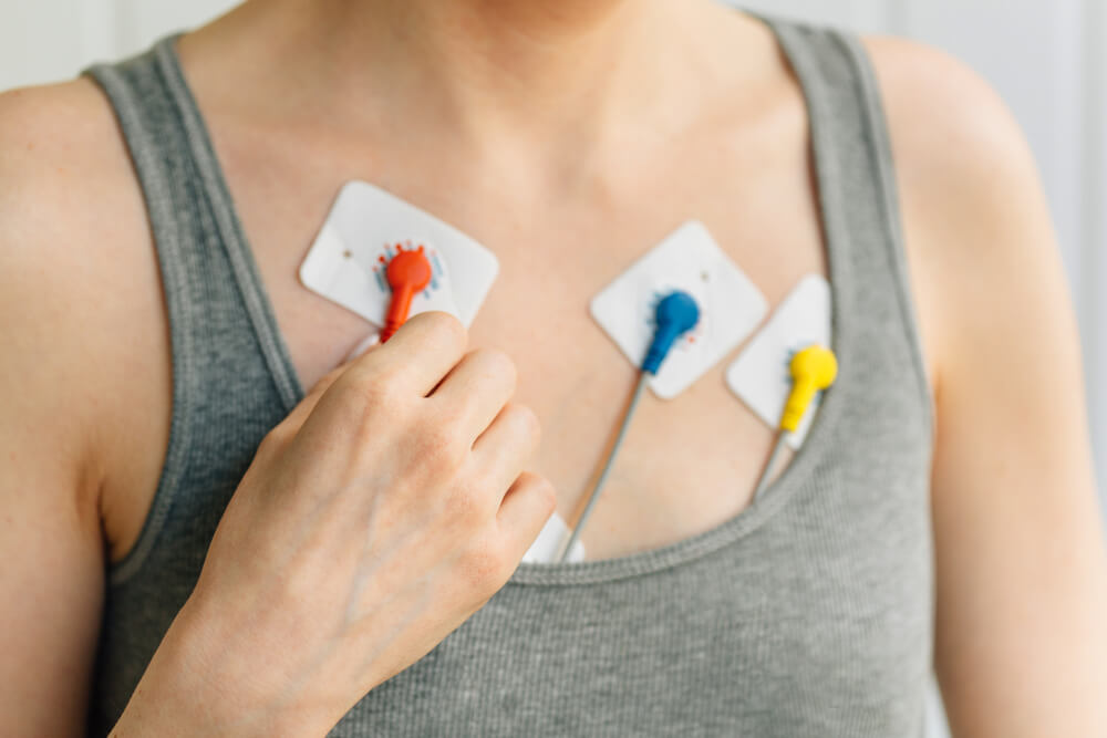 holter srca