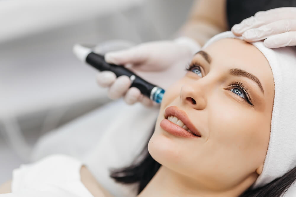 Microneedling tretman – Otklonite nepravilnosti na koži!
