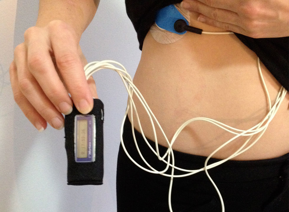 holter ekg pregled
